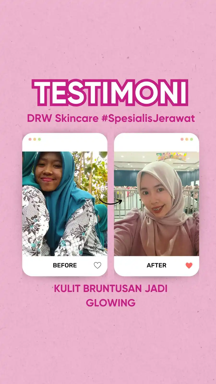 Image from DRW Skincare: AKU SEDIH BANGET PAKAI PRODUK SKINCARE DARI BRAND INI! Kenapa nggak d...