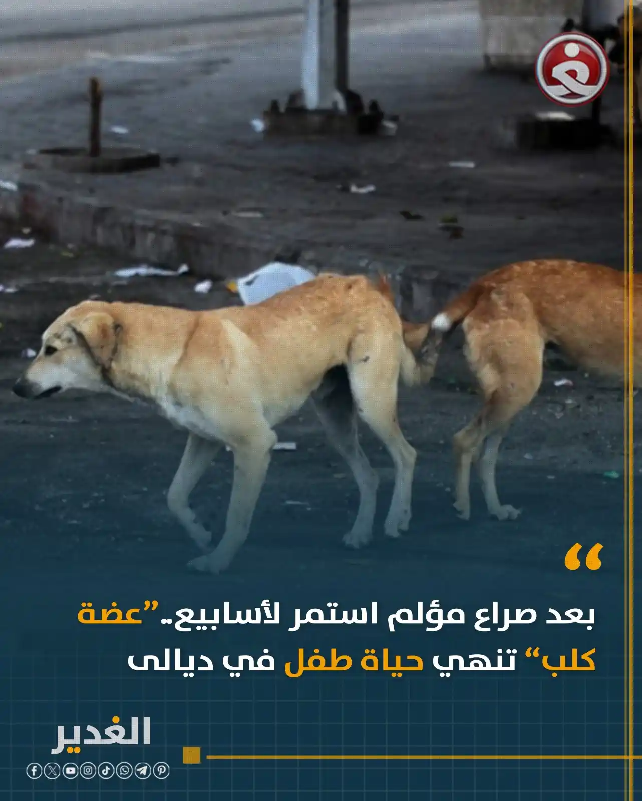 Image from قناة الغدير الفضائية: بعد صراع مؤلم استمر لأسابيع..“عضة كلب” تنهي حياة طفل في ديالى <a clas...