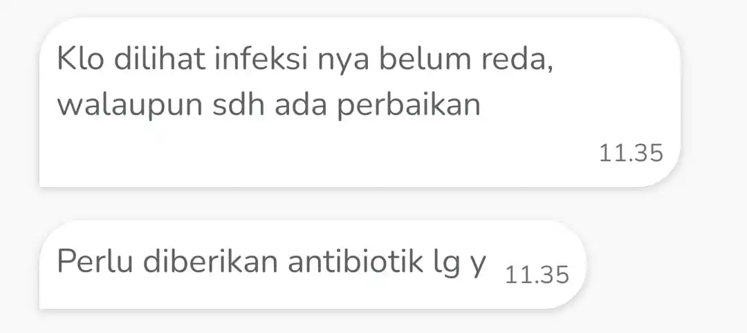 Image from Frederett ⚠️: sabar live nya, sumpah masih batuk pilek...