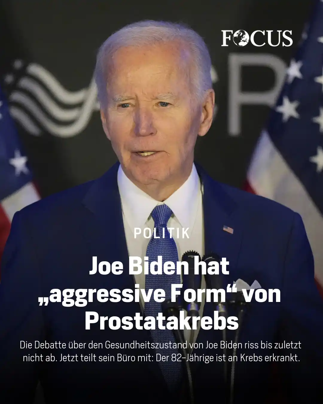 Image from FOCUS Magazin: Zweifel an seiner Gesundheit hatten im vergangenen Jahr zu seinem Rück...