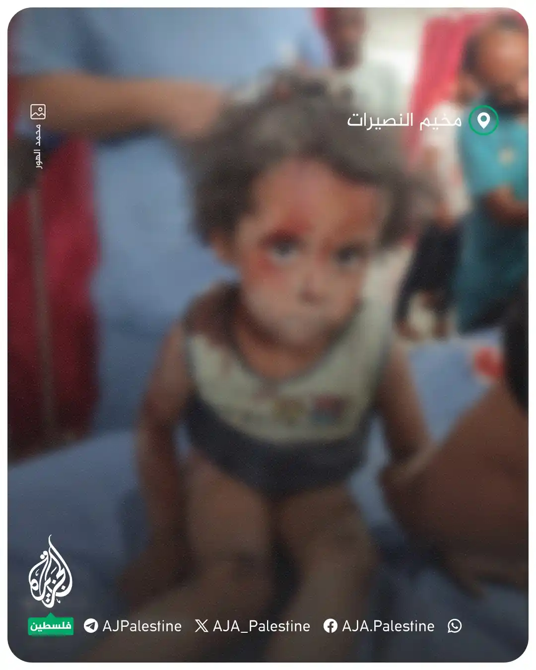 Image from غزة فلسطین الآن 🇵🇸 Gaza Palestine Now الجزيرة اخبار الجزیرۃ Updates, Islamic Arabic Urdu & English: 💔A number of children were injured in a bom__bing that targeted a hou...