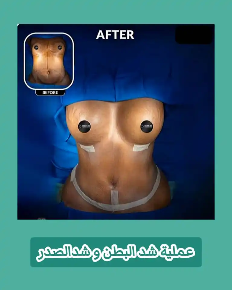 علاج وتجميل في شيراز 🇮🇷 post
