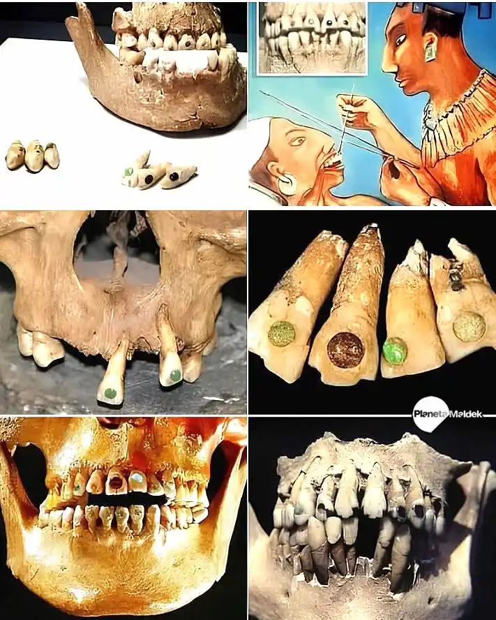 Image from Planeta Maldek: ¿Sabías que los antiguos mayas poseían avanzadas técnicas de odontolog...