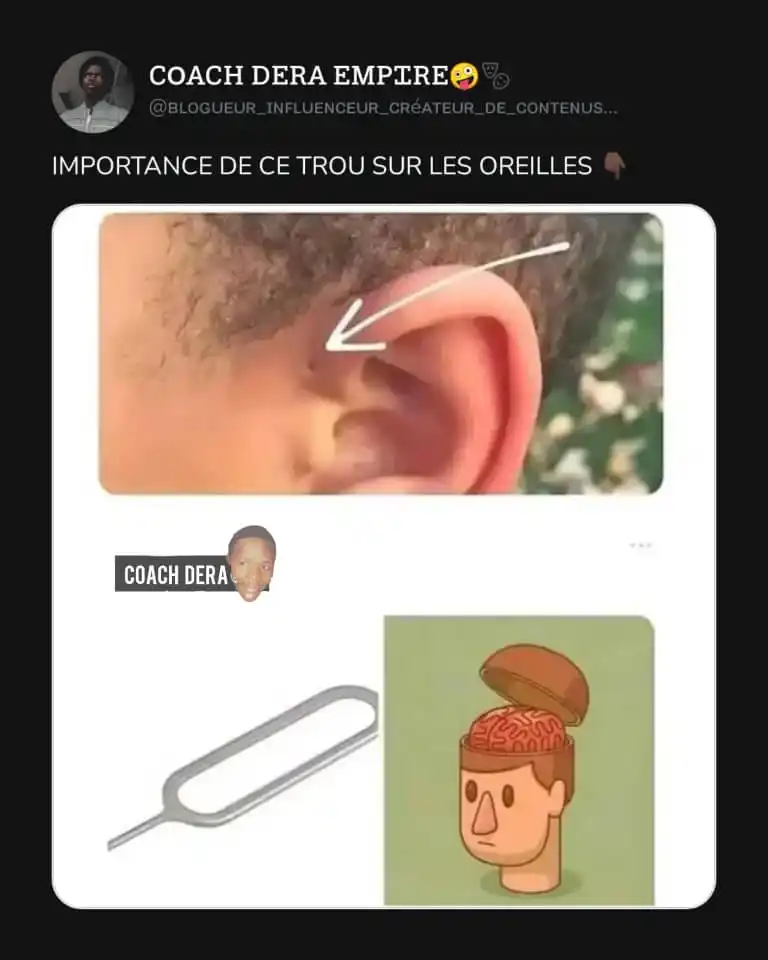 Image from DÉRA ✘: Astuces du jour🥴🥴🥴😂  Notre tiktok: https://tiktok.com/@blogueur.de...