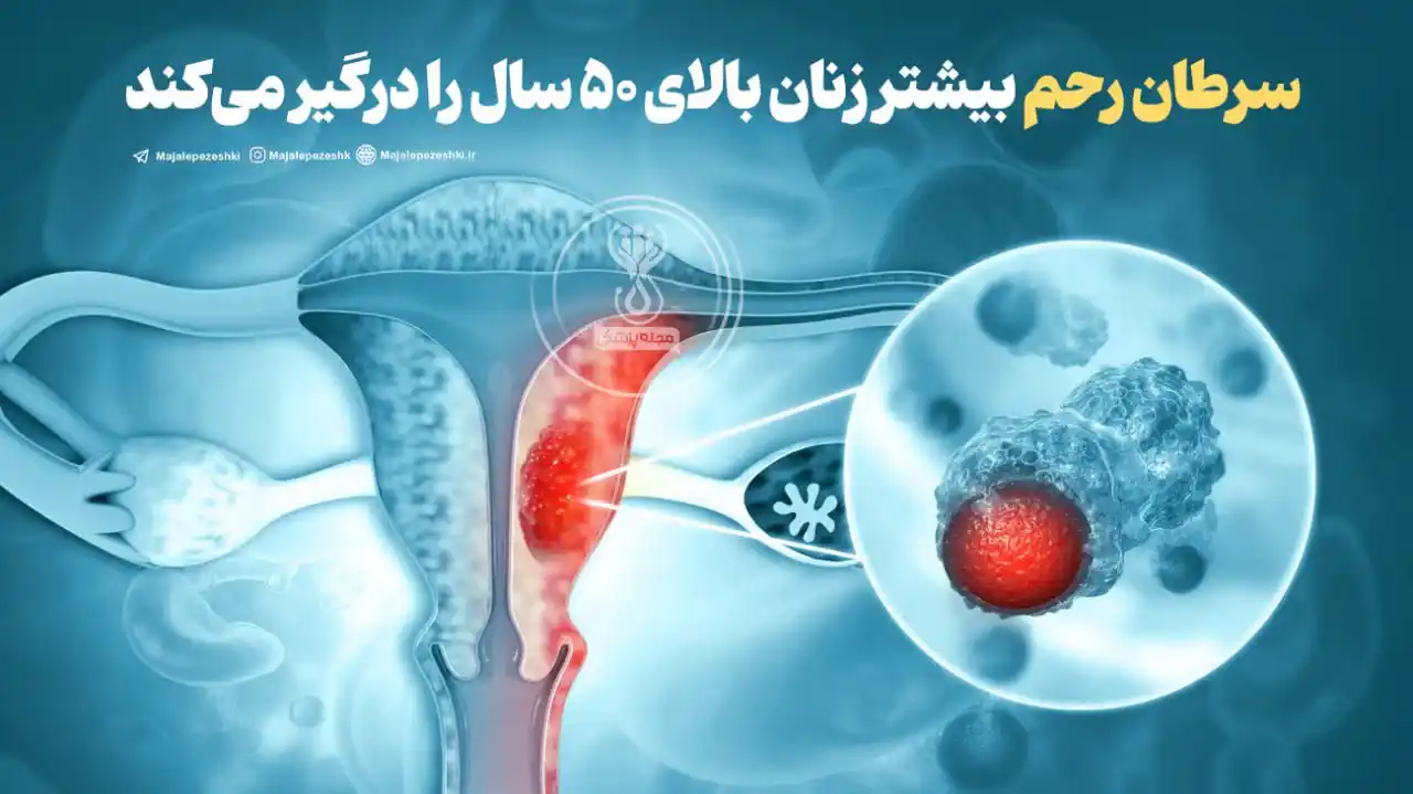 Image from طبیب بانوان 🥼🩺💊: سرطان رحم بیشتر زنان بالای ۵۰ سال را درگیر میکند! ◽️سرطان رحم، که بی...