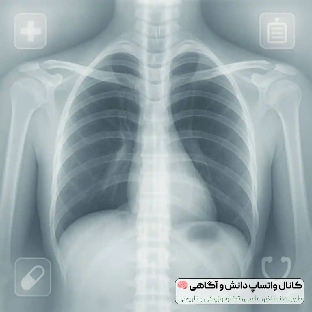 Image from دانش و آگاهی 🧠: *🩻 رادیوگرافی (X-Ray) چیست؟!* رادیوگرافی یکی از پرکاربردترین روشهای...