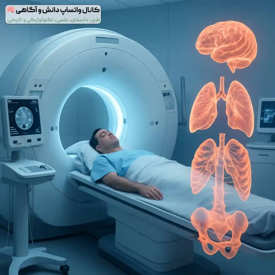 Image from دانش و آگاهی 🧠: 🌀 *سیتی اسکن چیست؟* یک روش تصویربرداری پیشرفته است که با کمک اشعه...