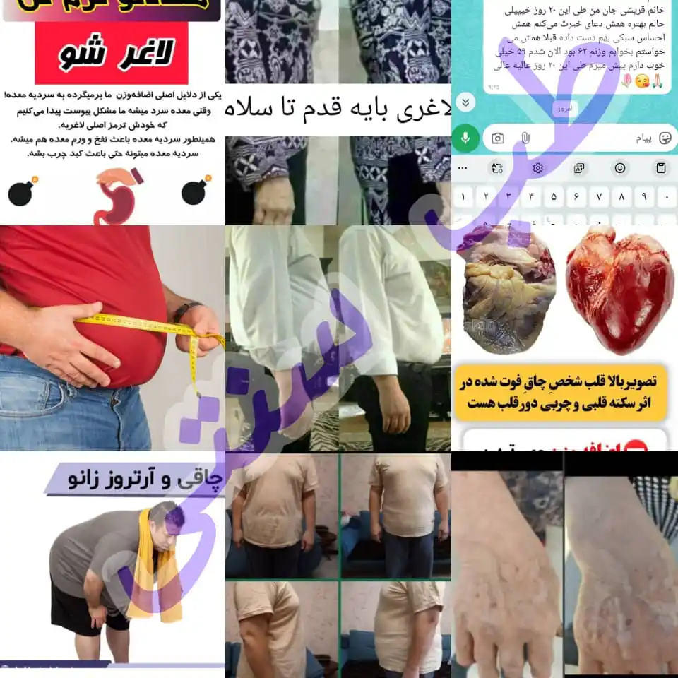 Image from عصرقشم: 💥از بیماری خسته نشدی 😔 😔 وقتش نشده سلامتی به خودت هدیه بدی🥳🥳 هر...
