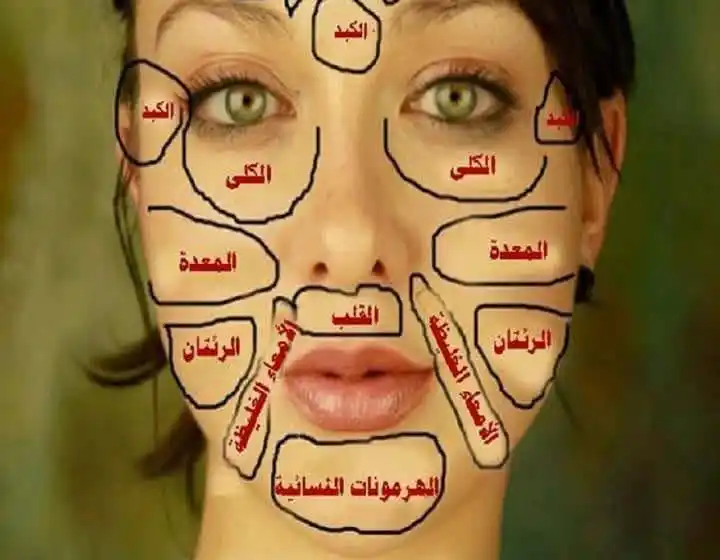 Image from International Digital Academy channel: هذه خريطة الوجه القديمة ستخبرك ما هو المرض الذي تعاني منه وكيفية علاجه...