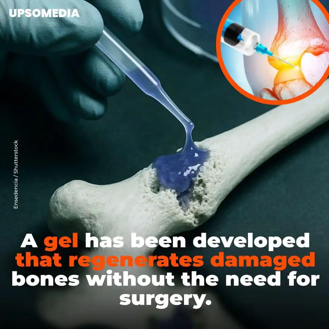 Image from ⚕𝐊𝐡𝐲𝐛𝐞𝐫 𝐌𝐞𝐝𝐢𝐜𝐚𝐥 𝐔𝐧𝐢𝐯𝐞𝐫𝐬𝐢𝐭𝐲 𝐏𝐞𝐬𝐡𝐚𝐰𝐚𝐫, 🧑‍⚕️𝐒𝐚𝐌𝐢𝐢𝐢-𝐊𝐌𝐔🩺: Scientists at POSTECH University in South Korea have developed an inje...