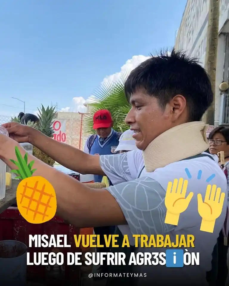 Image from Infórmate y más: ¡Más fuerte que nunca! 💪🏻 🥥🪙Misael, joven que fue agredido brutalm...
