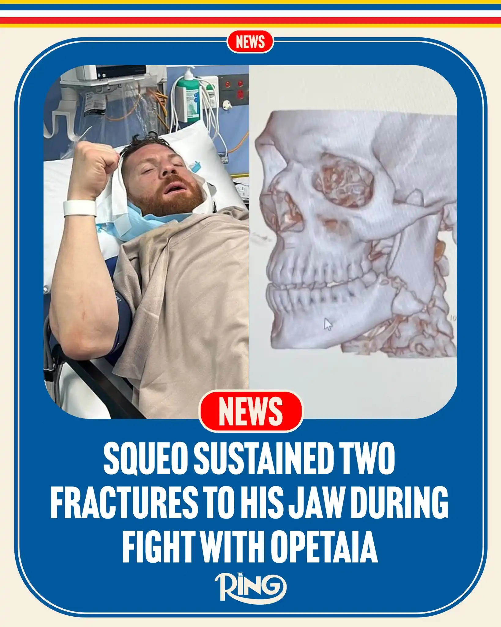 Image from Ring Magazine: Claudio Squeo has confirmed that he underwent successful surgery follo...