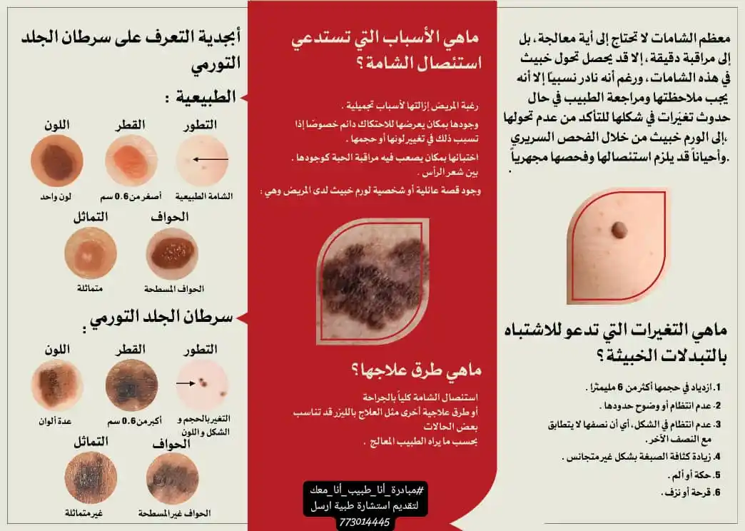 Image from مبادرة انا طبيب انا معك Dr.omarfakih: هناك عدة أسباب قد تستدعي استئصال <a class="text-blue-500 hover:underli...