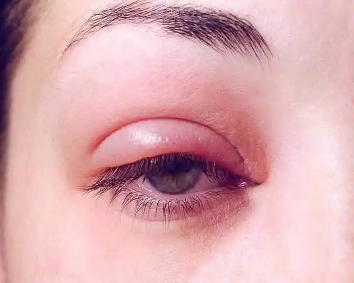 Image from مبادرة انا طبيب انا معك Dr.omarfakih: قد تحدث <a class="text-blue-500 hover:underline cursor-pointer" href=...