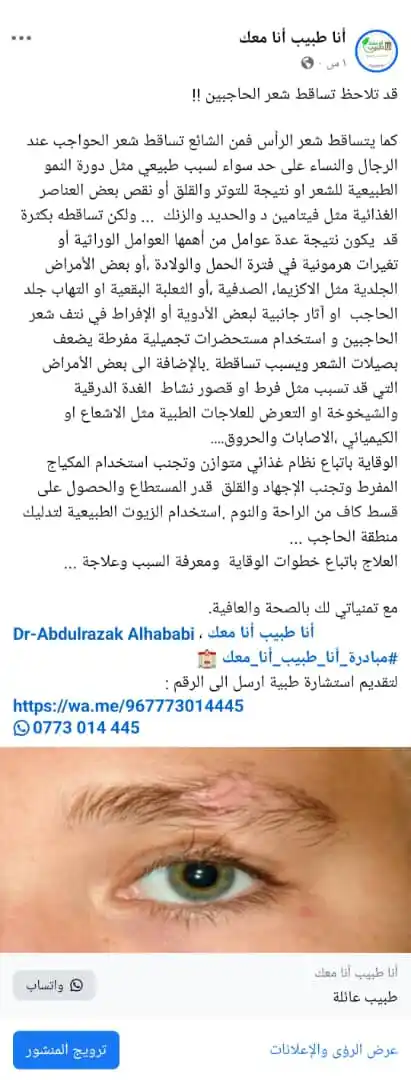 Image from مبادرة انا طبيب انا معك Dr.omarfakih: قد تلاحظ تساقط شعر الحاجبين كما يتساقط شعر الرأس فمن الشائع تساقط شع...