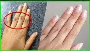 Image from Skincare & Hair Tips🧴🦱: common effective home remedies for dark knuckles*💜:  1. _Lemon Juice ...