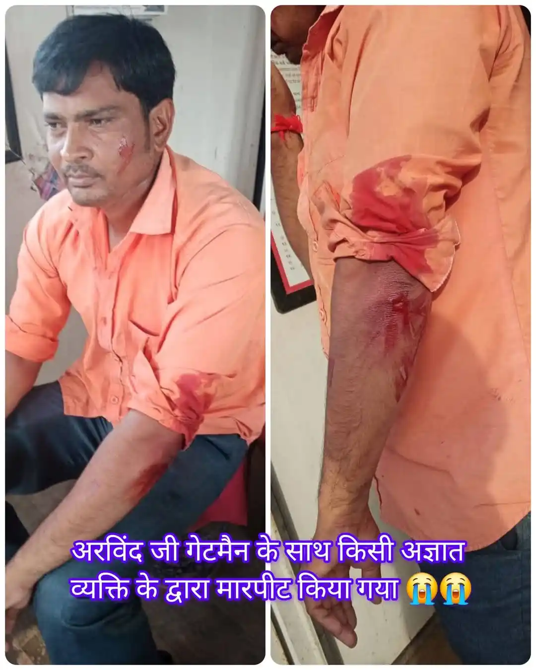Image from AIRTU ALL ZONE OFFICIAL / ALL INDIA RAILWAY Trackmaintainer UNION Official Channel: अरविंद जी गेटमैन के साथ किसी अज्ञात व्यक्ति के द्वारा मारपीट किया गया ...