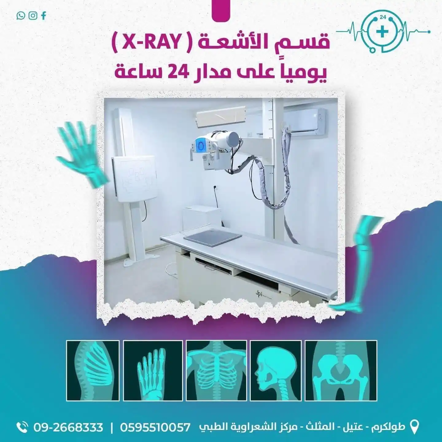 Image from مركز الشعراوية الطبي - معلومات طبية: قسم تصوير الأشعة السينية (X-RAY) المزود بأحدث الأجهزة وبإشراف فنيين وأ...