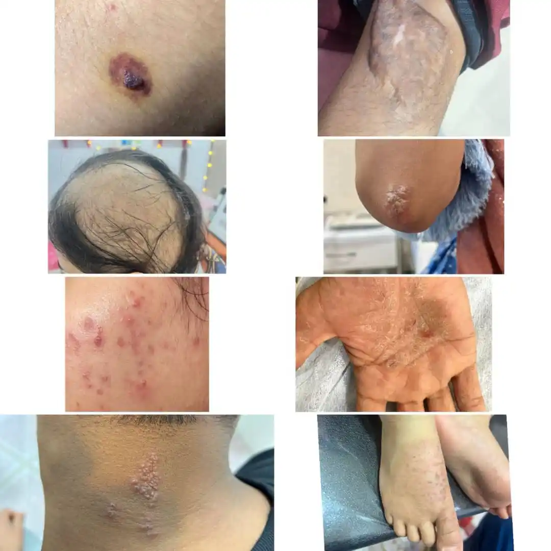 Image from کانال اخبار قشم: خدمات قابل ارائه در *کلینیک دکتر پیمان خالدی:* *✅ لیزر موهای زائد سر...