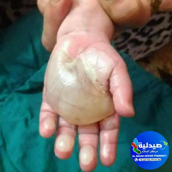 Image from صيدلية مركز السلام الطبي Al Salam Medical Center Pharmacy: *((((توعية صحية)))* <a class="text-blue-500 hover:underline cursor-po...
