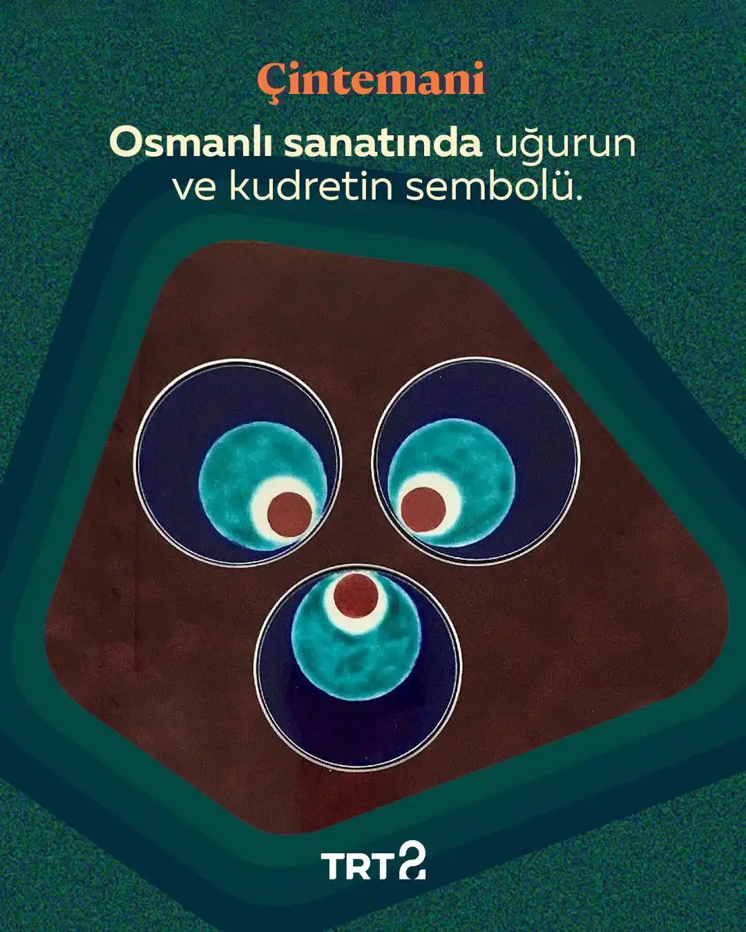 TRT 2 post