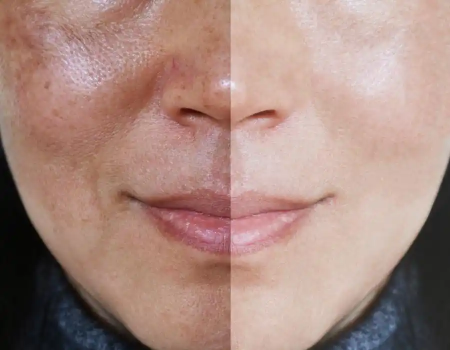 🖤 M𝒴 Ri𝒩𝒞Ó𝒩 🖤 post