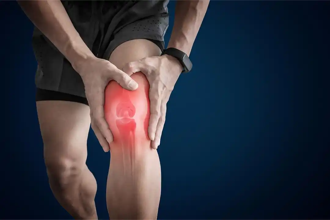 Image from The Male Nurse 👨🏽⚕️: - Psoriatic arthritis This occurs in people with psoriasis, which is...