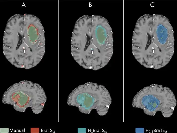 Image from e-Radiologia: [Radiology: Artificial Intelligence] Robust Deep Learning–based Segmen...