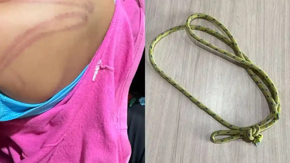 Image from g1Amapá: *Mulher é presa suspeita de espancar filha de 5 anos com corda em Ferr...