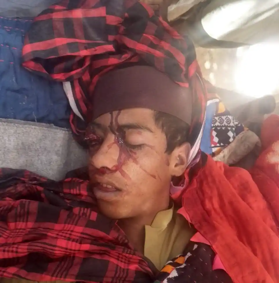 حب چوکی  ساکران  نیوز🕐 post