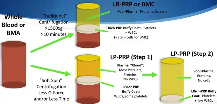 Image from Sports-Exercise Medicine & Sciences: Lifestyle & Performance Medicine, Dept. of Physiology, IMS, BHU: Centrifugation of blood and BMA @M.Murphy...