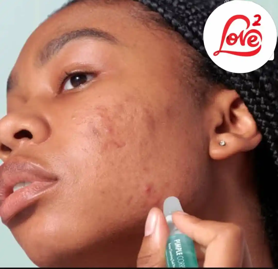 Image from LOVE SQUARE ♥️: ✍️Healthy tips to reduce pimples; -Avoid skincare products that cont...