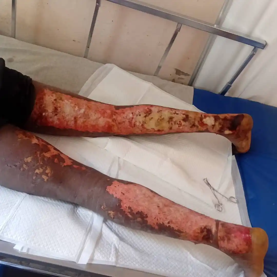 Image from Nationalfm: Karoi chivende kune mukomana arikupomherwa mhosva yekuba hembe akatiza...