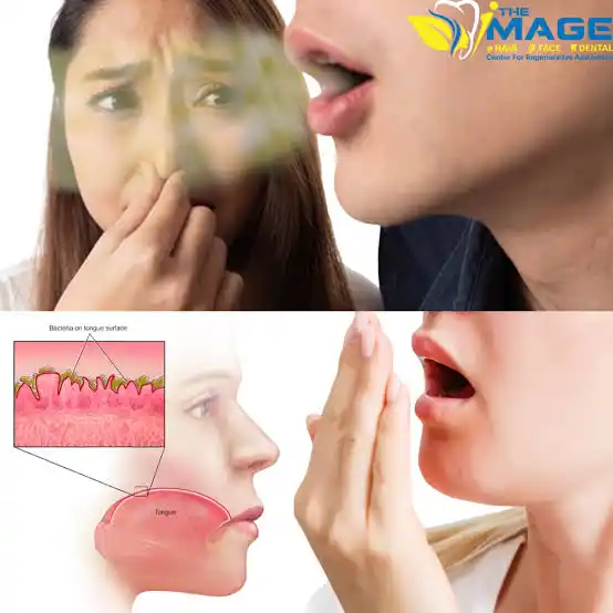 Image from Elyon Health Tips: HALITOSIS is simply known as bad breathe/smelling mouth The following ...
