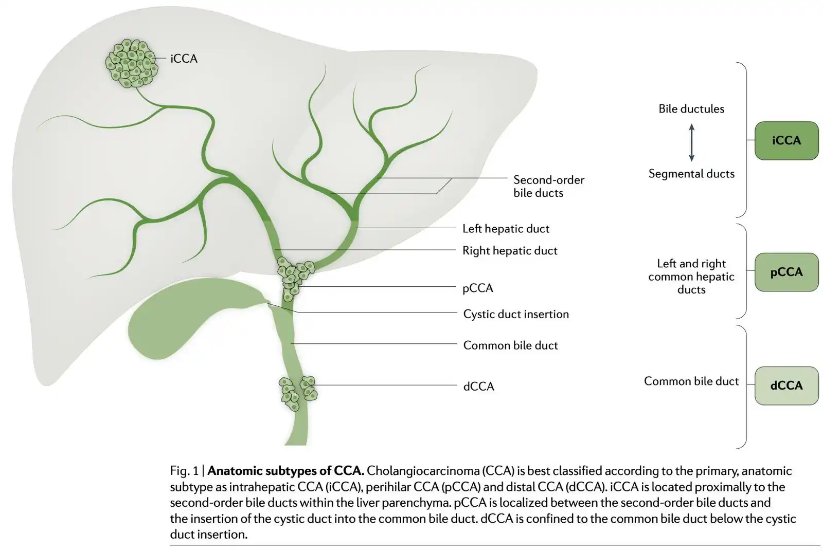 Image from Medicina Basada En Evidencia⚕️: 🔰Colangiocarcinoma - Subtipos (anatomía): -Intrahepático (iCCA): pro...