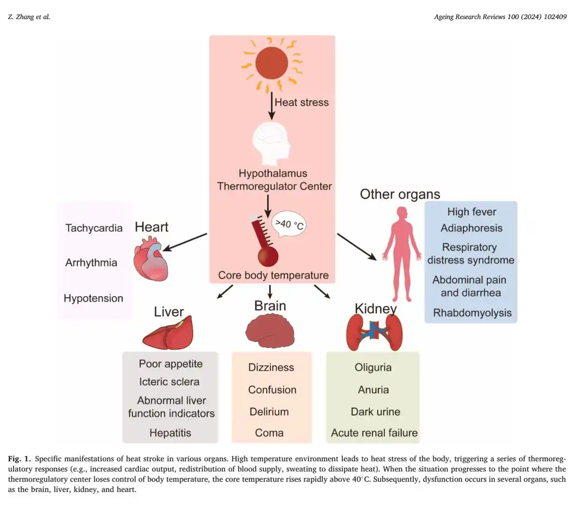 Image from Medicina Basada En Evidencia⚕️: Golpe de calor🌞 Diagnóstico • Basado en fiebre >40 °C, disfunción n...