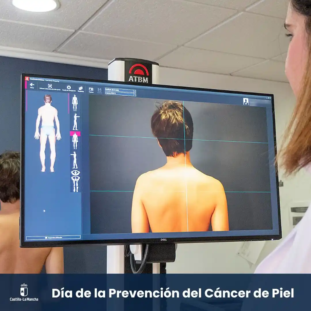 Image from Junta de Comunidades de Castilla-La Mancha: 🗓️ *Hoy se celebra el Día de la Prevención del Cáncer de Piel* Un dí...