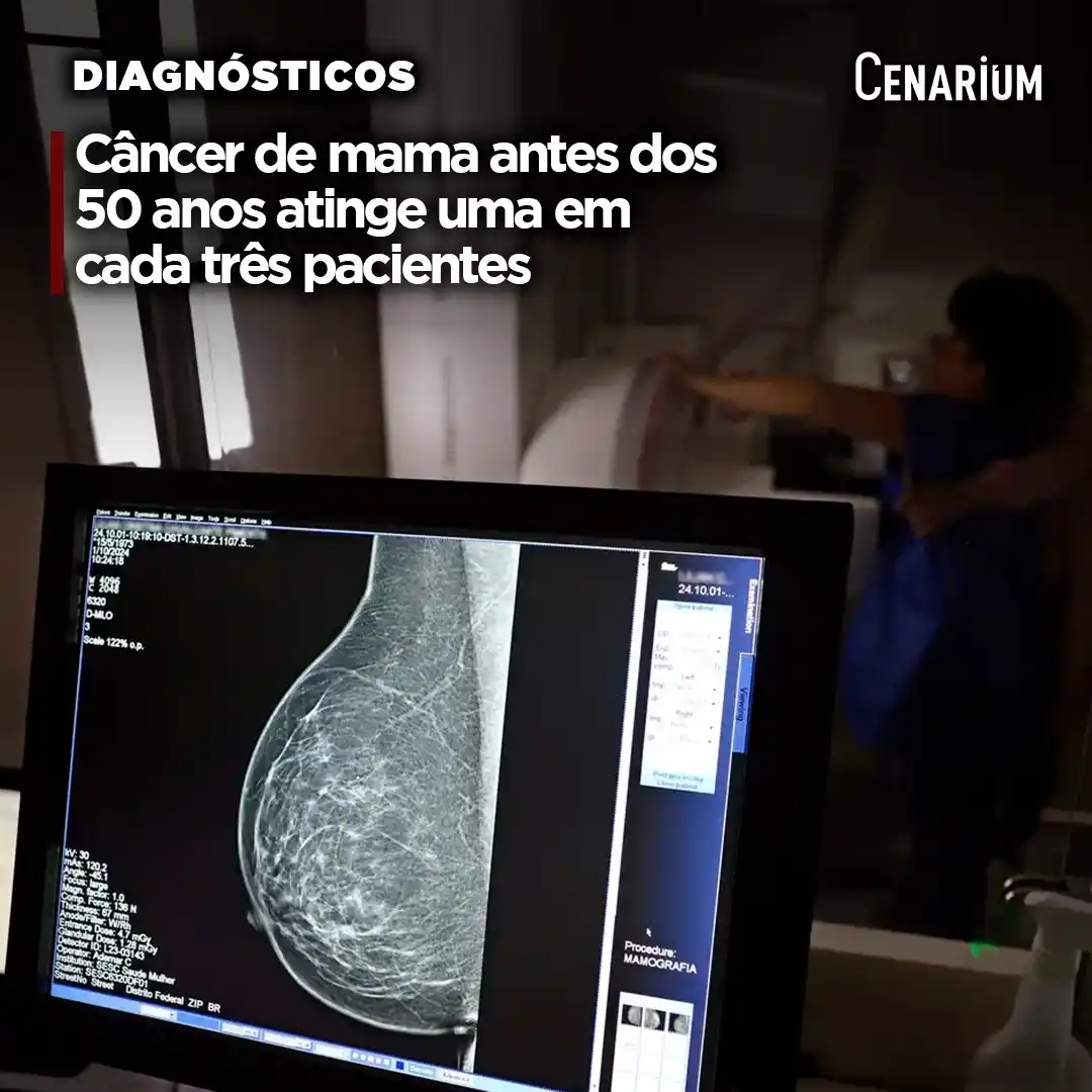 Image from CENARIUM: 🏥 *Câncer de mama antes dos 50 anos atinge uma em cada três pacientes...