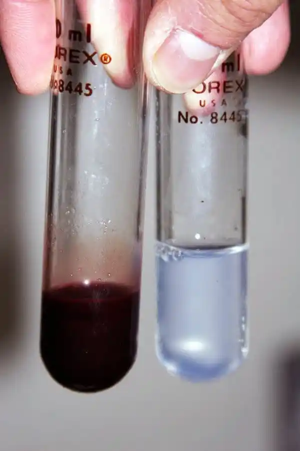 Image from Dopamine Clinical: هذا الد.م يعود لسمكة تُعرف باسم "سمكة الجليد" (Icefish) التي تعيش في أ...