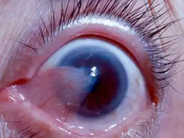 Dopamine Clinical post