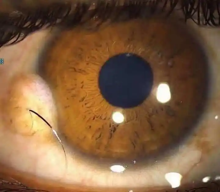 Dopamine Clinical post