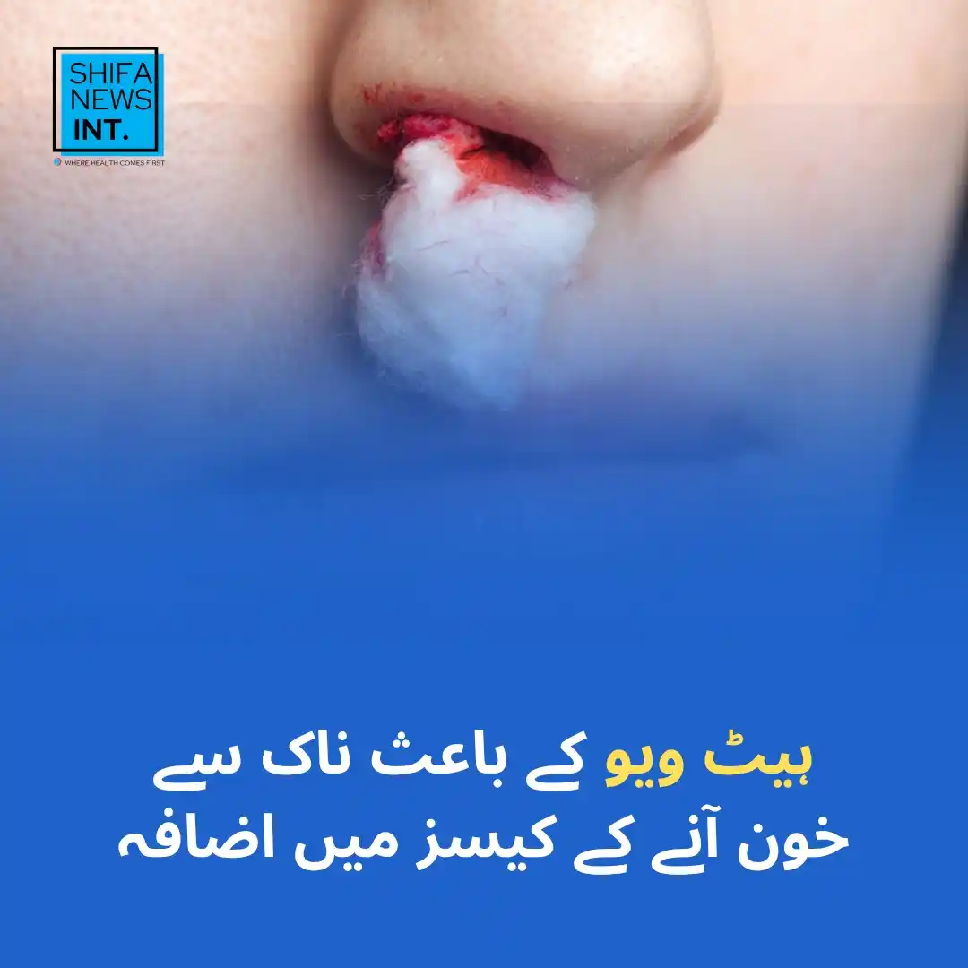 Image from Shifa News - Digital Health Platform: 8️⃣ راولپنڈی اور اسلام آباد میں شدید گرمی کے باعث ناک سے خون آنے کے کی...