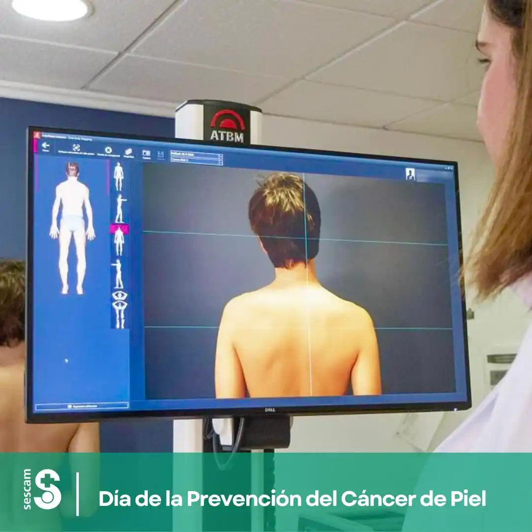Image from SESCAM: 🗓️ *Hoy se celebra el Día de la Prevención del Cáncer de Piel* Un dí...