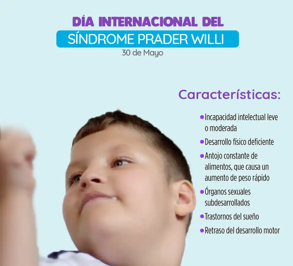 Image from Noticias del Colegio de Farmacéuticos de la provincia de Buenos Aires: El 30 de mayo se conmemora el *Día Internacional del Síndrome Prader W...