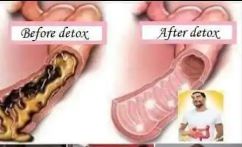 Image from Selfcare Sanctuary🏪: Kusuka muviri wemunhurume?/Detoxification Kusuka muviri wemunhurume ...