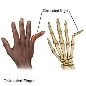 Image from World Cricket Updates: This was Smith injury...