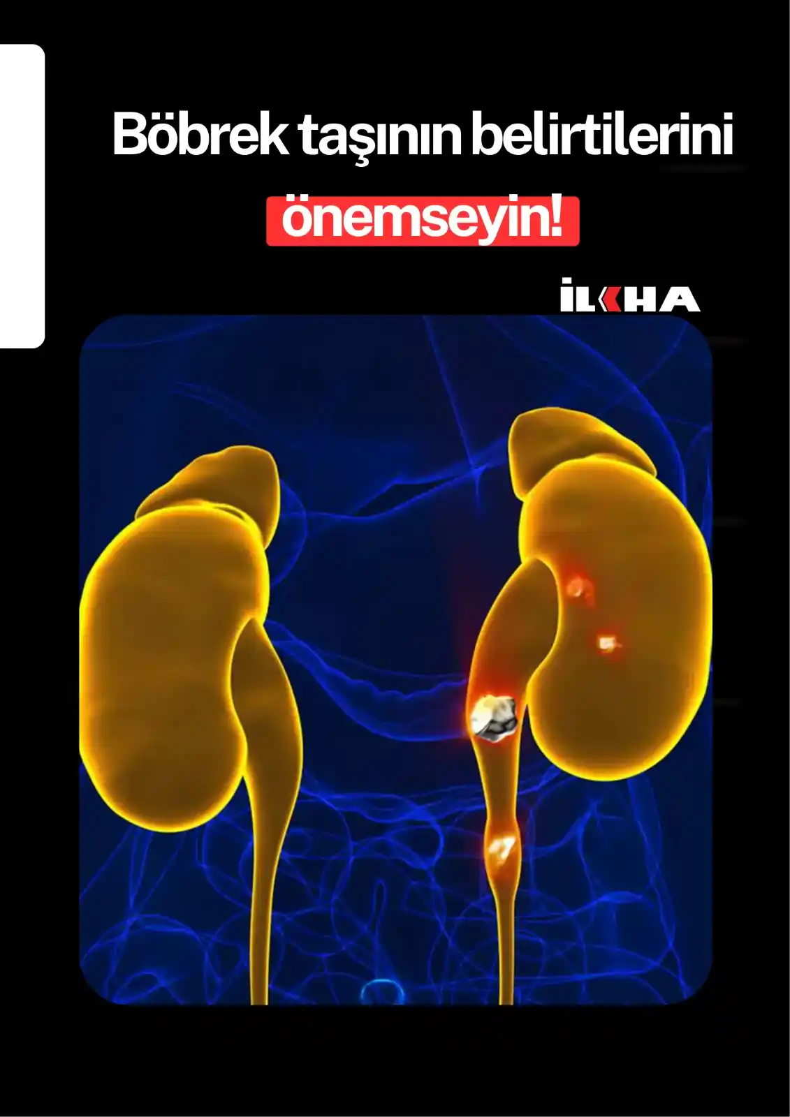 İlke Haber Ajansı (İLKHA) post