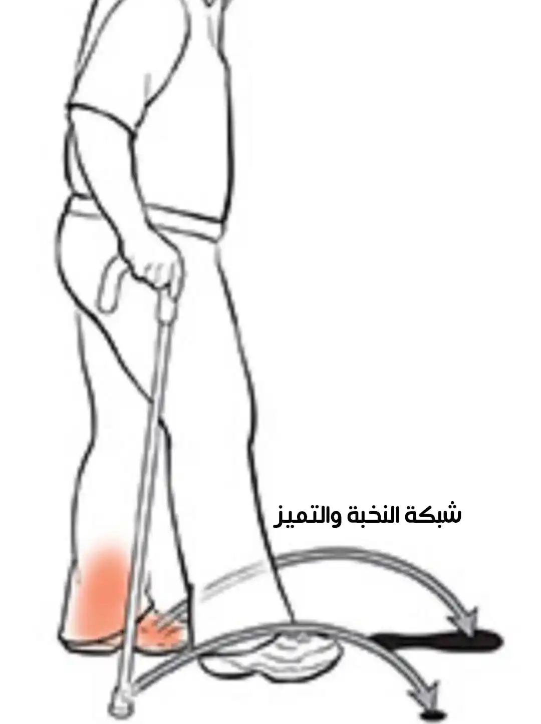 Image from 💧من كل بحرٍ قطـــرة💧: 💧 ❌ من الأخطاء الشائعة لدى المرضى 👴👵 استخدام العكاز 🧑🦯 مع الجهة...