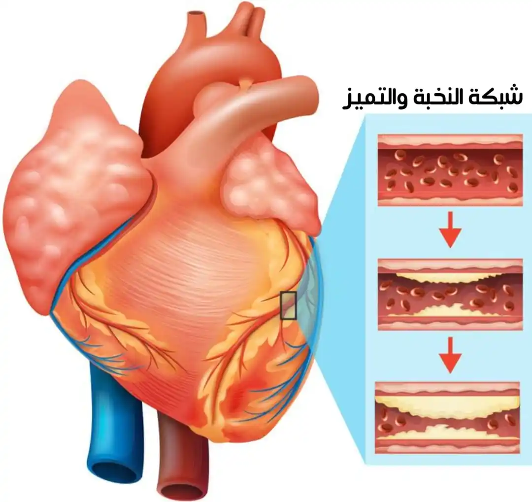 Image from 💧من كل بحرٍ قطـــرة💧: 💧 *طرق منزلية فعالة لعلاج الكوليسترول* • المشي اليومي أبدأ بـ 30 دق...