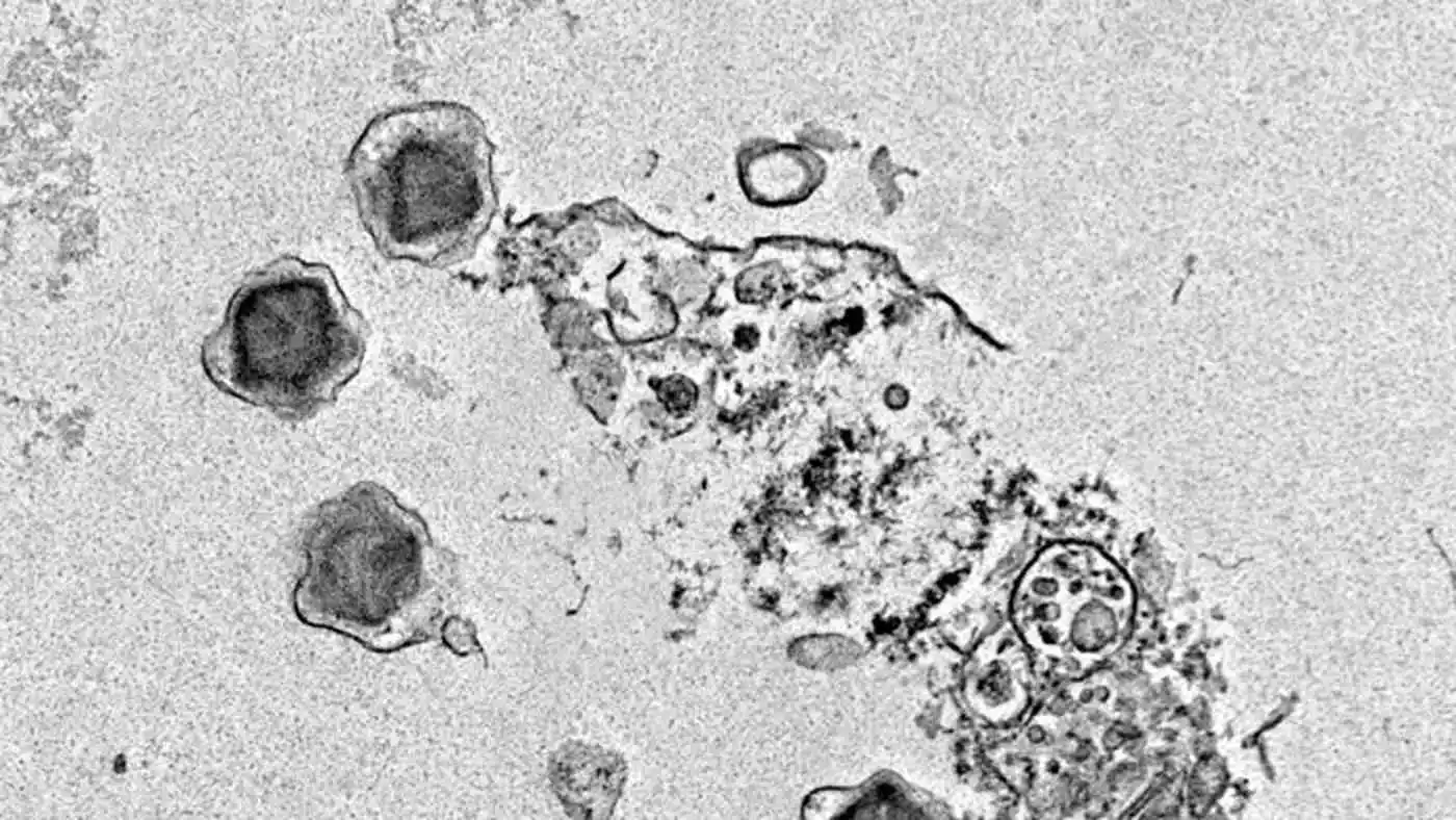 Image from Meteo.it: *Un nuovo studio ha scoperto 230 "virus giganti" che hanno un ruolo ch...